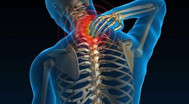 Osteocondritis de la columna