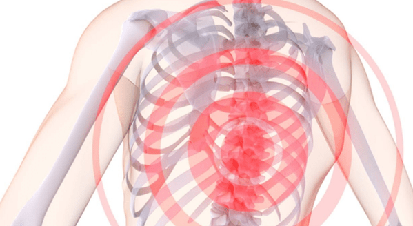 dolor en la columna con osteocondrosis torácica