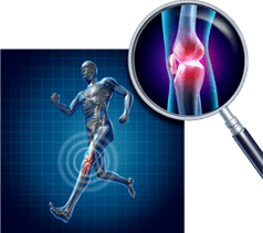 Artrosis de la articulación de la rodilla